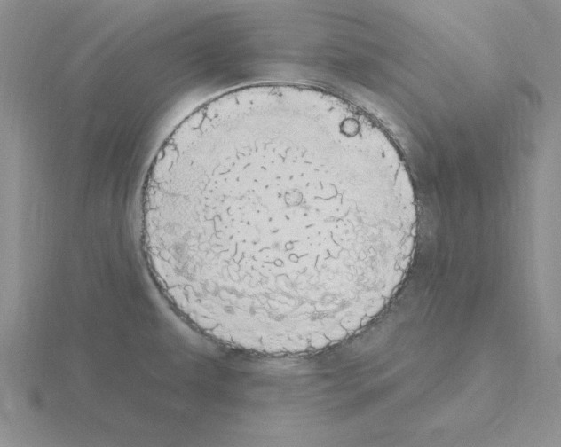 X0000115421479200912151552