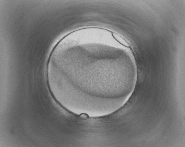 X0000115421527200912151552