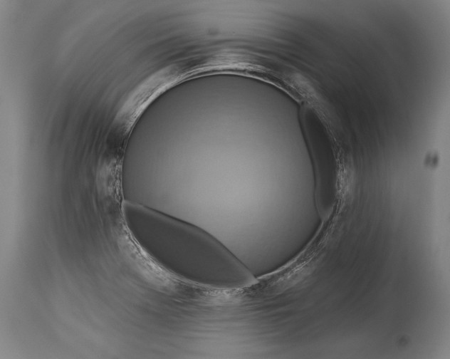 X0000115431369200911181450