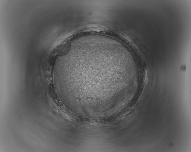 X0000115431399200911181450