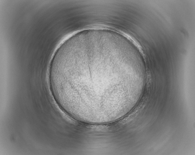 X0000115431429200912020915