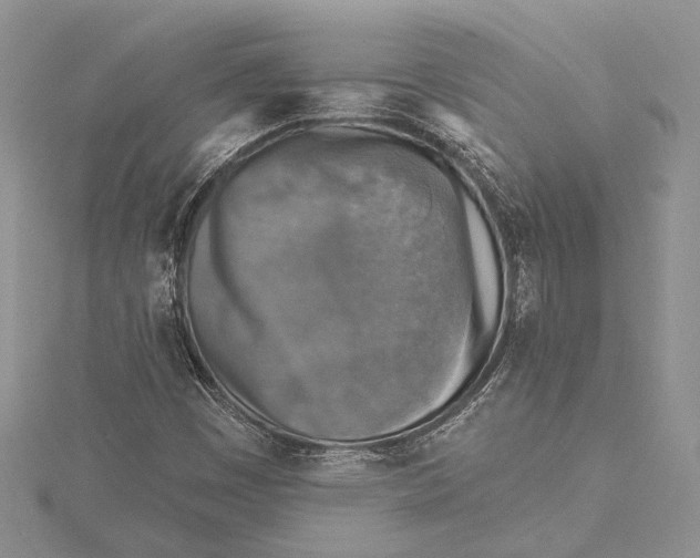 X0000115431449200912020914