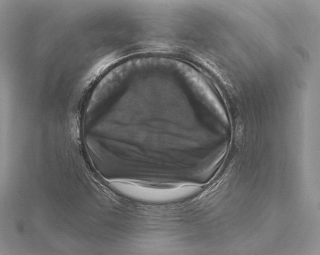 X0000115431455200912020914