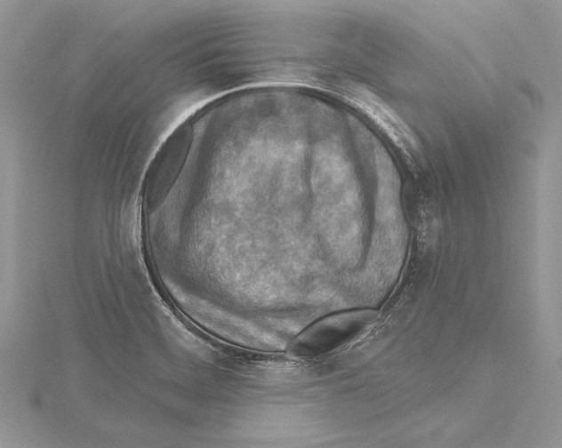 X0000115431468200912020914