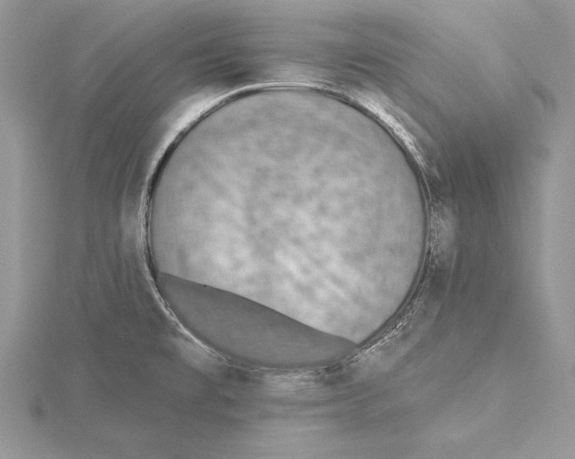 X0000115431477200912020914