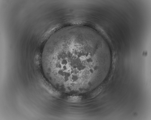 X0000115440161200911181532