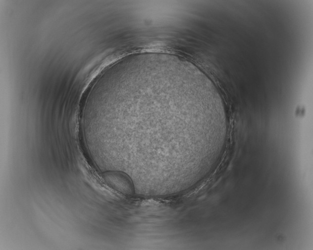 X0000115440290200911181530