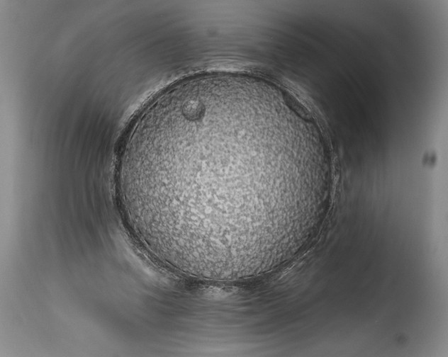 X0000115440346200911181528