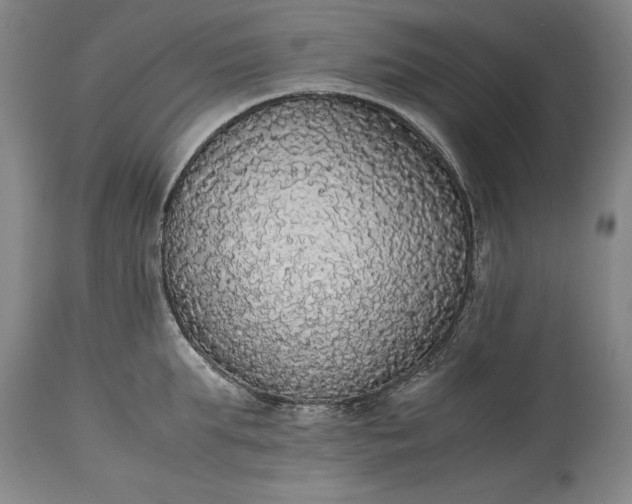 X0000115440903200911181520