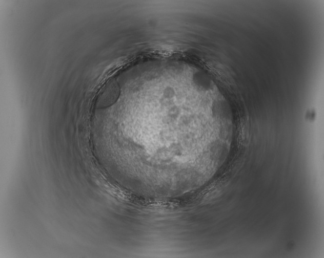 X0000115441105200911181517