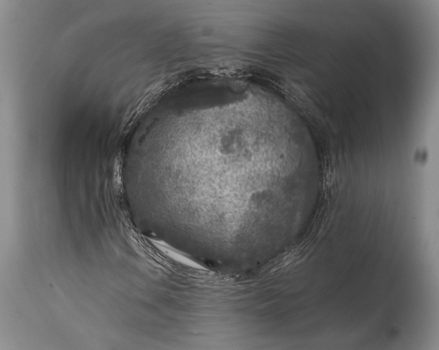 X0000115441106200911181517