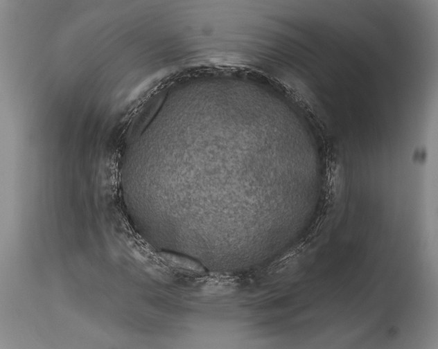 X0000115441110200911181517