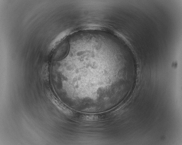 X0000115441403200911181513