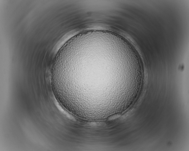 X0000115441433200911181513