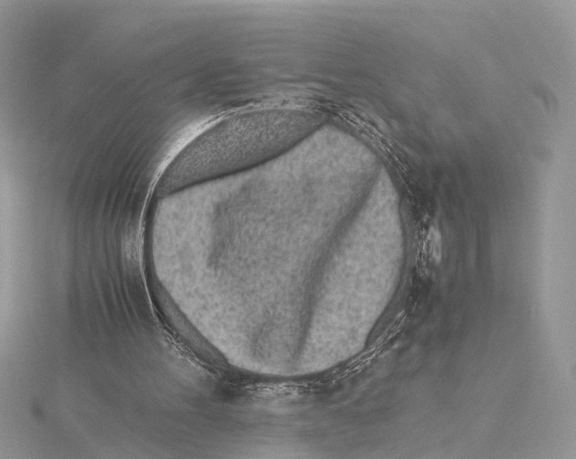 X0000115440100200912020953