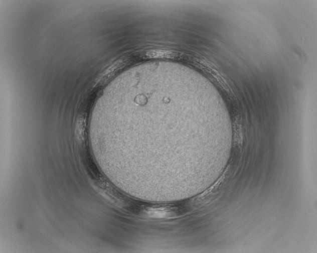 X0000115440171200912020952