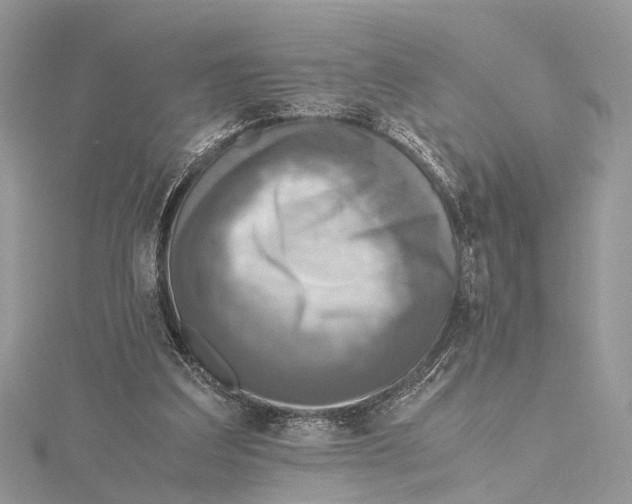 X0000115440203200912020952