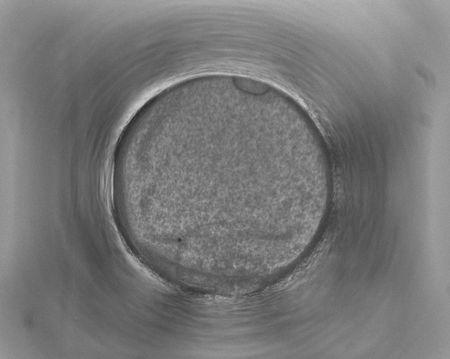 X0000115441515200912020934