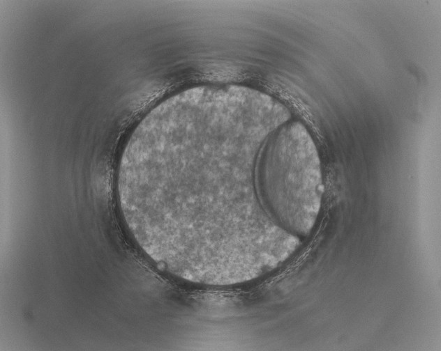X0000115440305200912161459