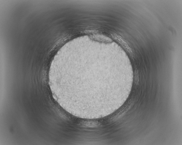 X0000115440449200912161457