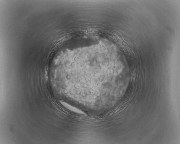 X0000115441106200912161449