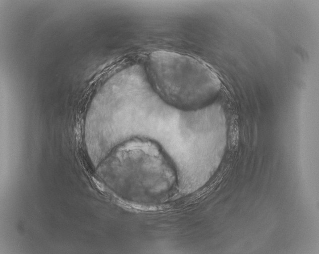 X0000115441397200912161445