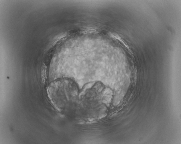 X0000115441399200912161445