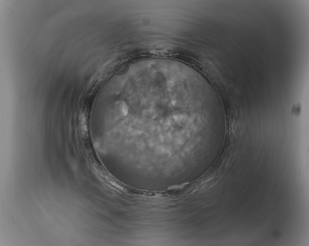 X0000115451106200911181540