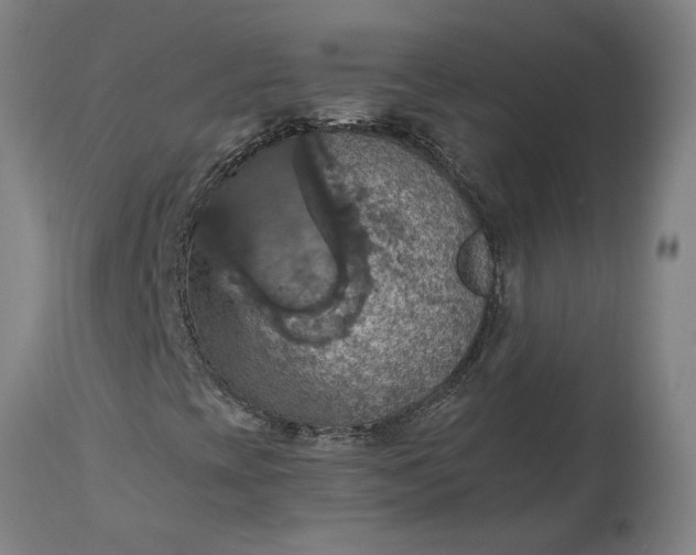 X0000115451393200911181536