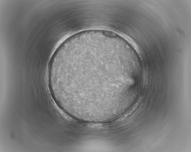 X0000115451006200912021002