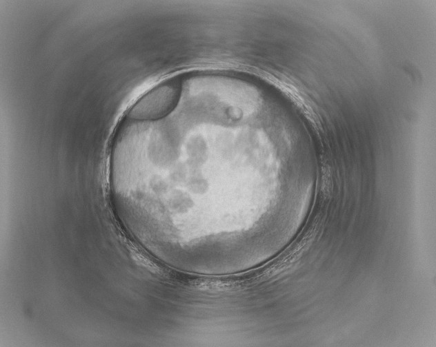 X0000115451366200912020957