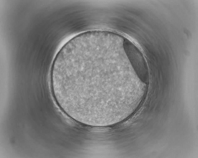 X0000115451440200912020957