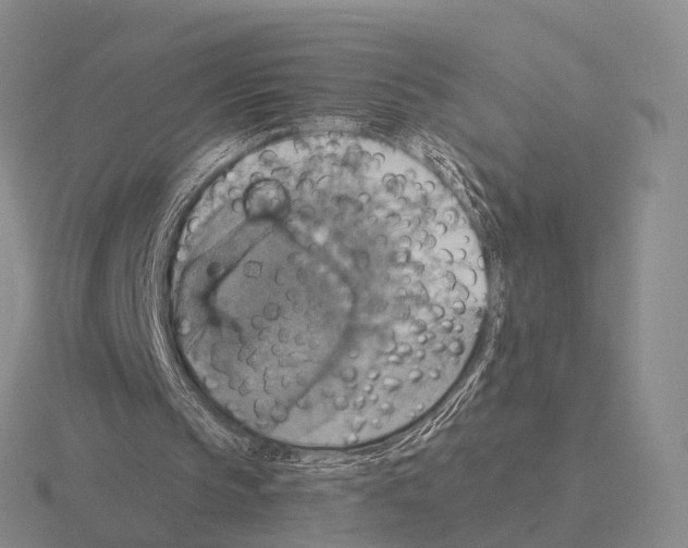 X0000115450145200912161521