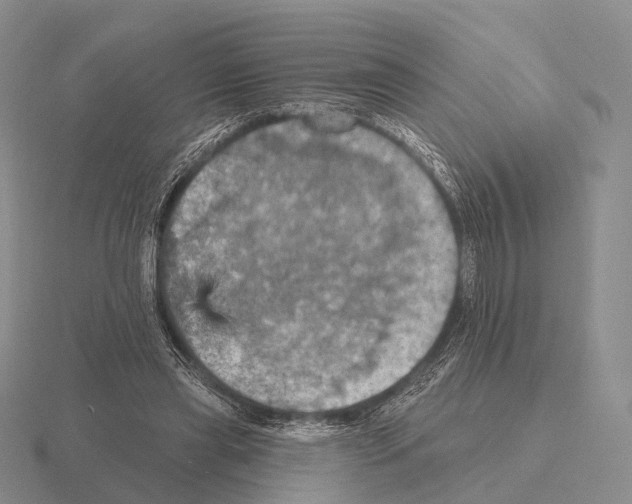 X0000115450445200912161517