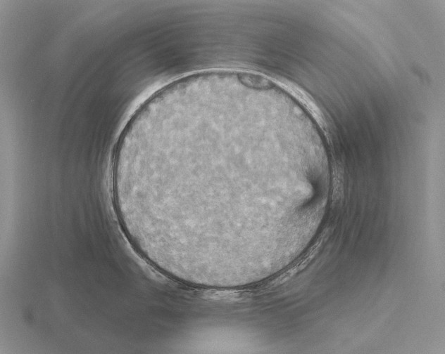 X0000115451006200912161510