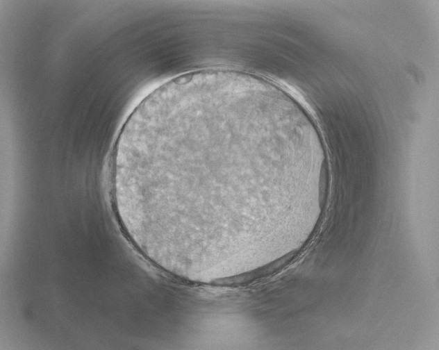 X0000115451056200912161510