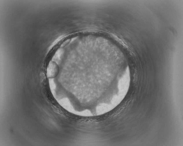 X0000115451400200912161505