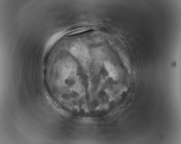 X0000115480149200912041001