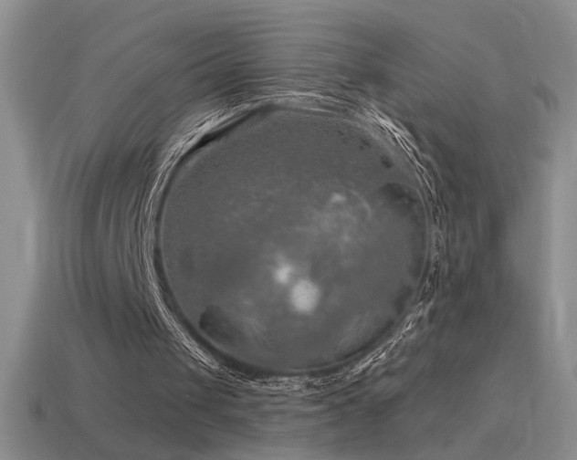 X0000115490049200911061315