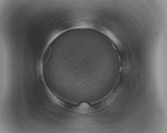 X0000115491468200911131226