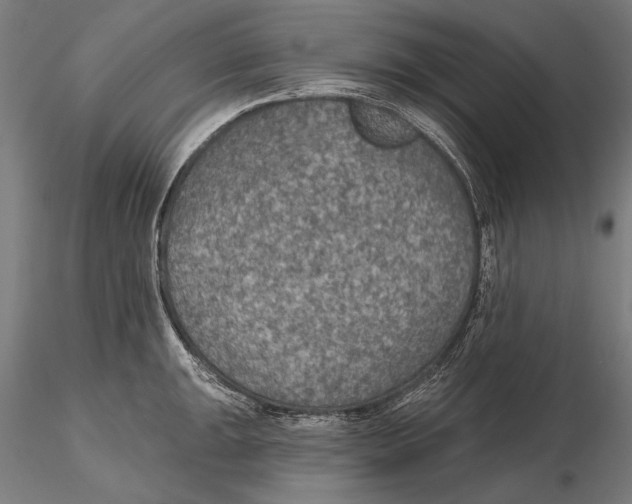 X0000115491047200912041011