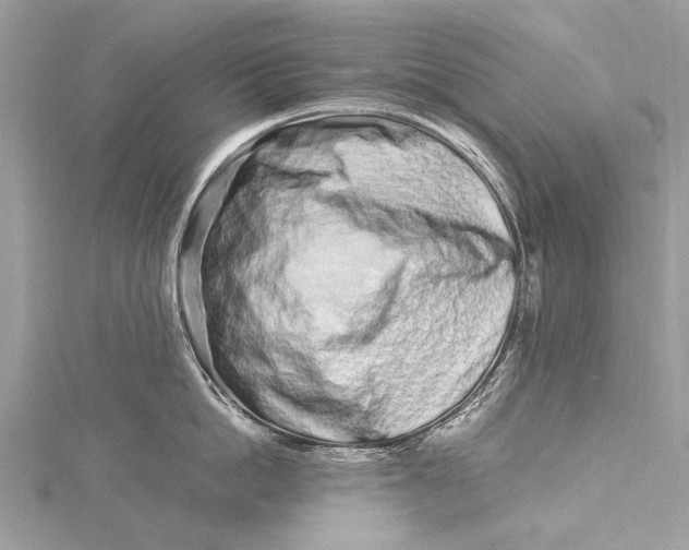 X0000115500862200911201617