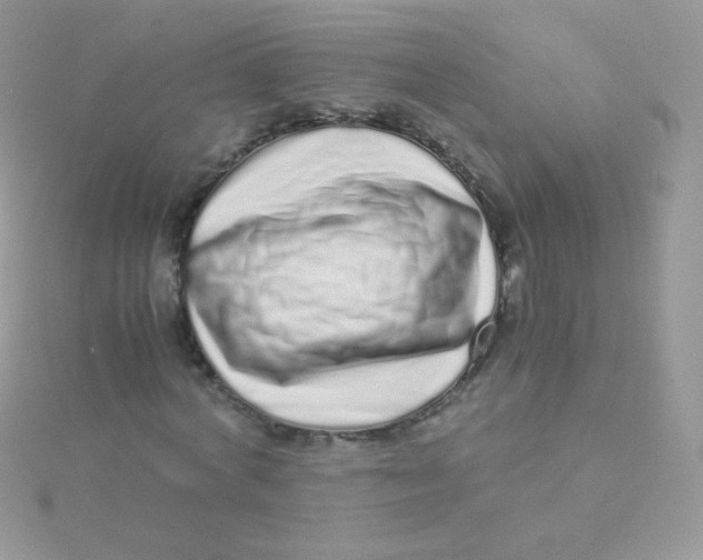 X0000115500772200911271409