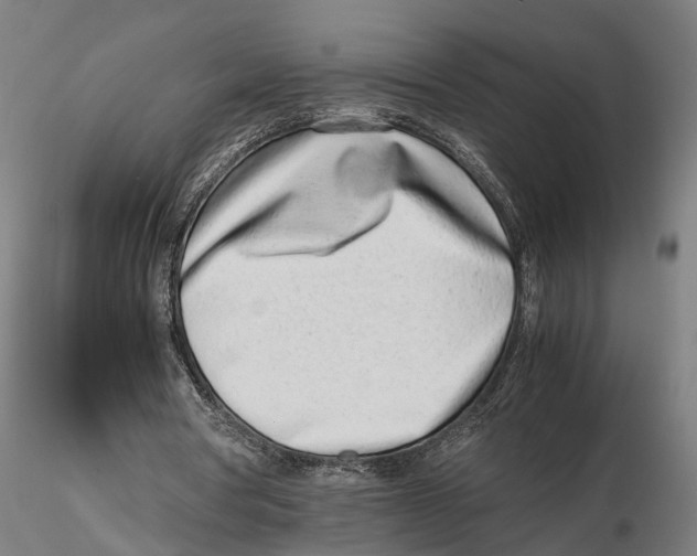 X0000115500386200912041043