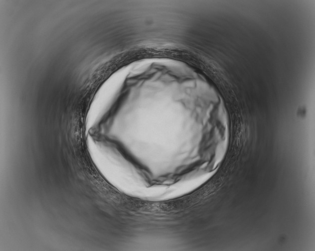 X0000115500966200912041034