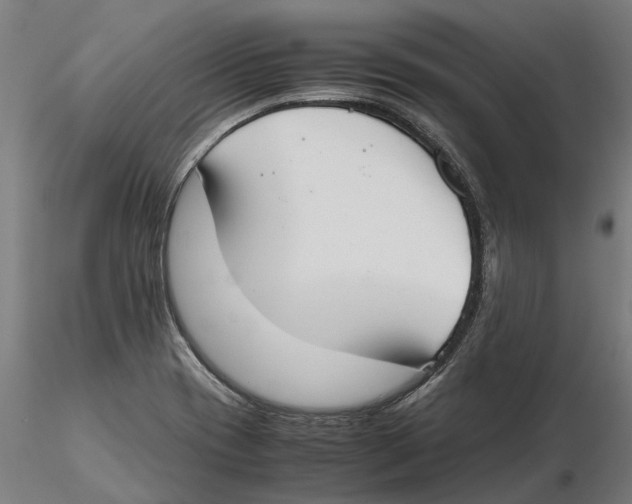 X0000115501417200912041028
