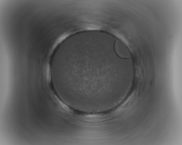 X0000115511171200911131335