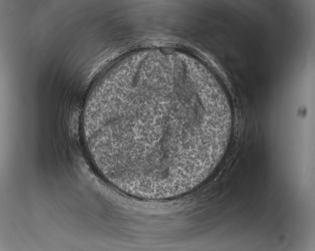 X0000115510010200912041112