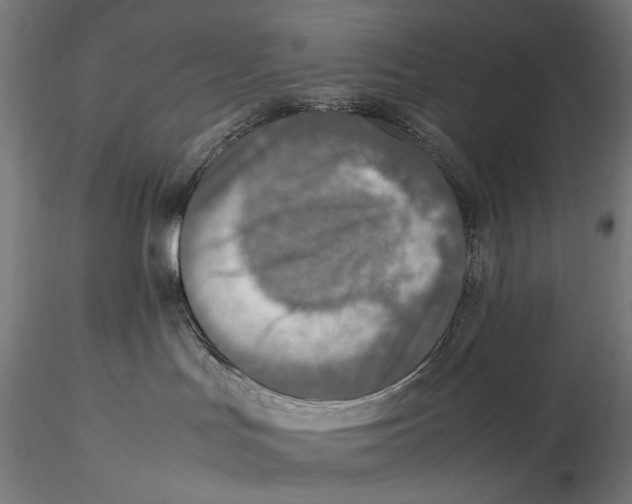 X0000115510047200912041112