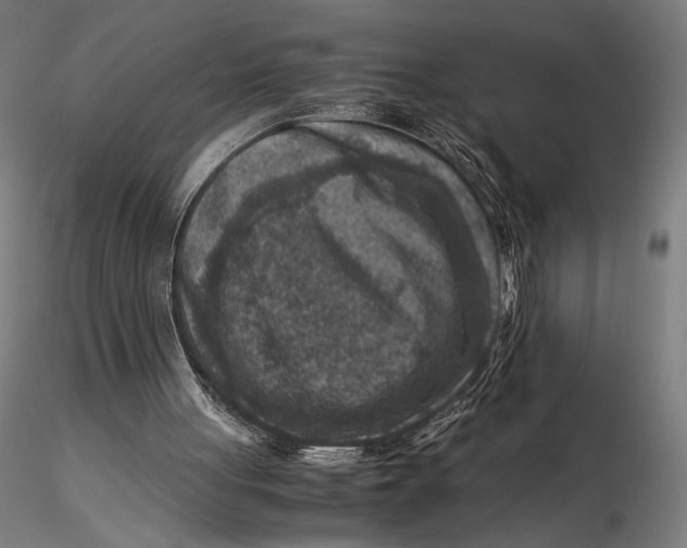 X0000115510051200912041111